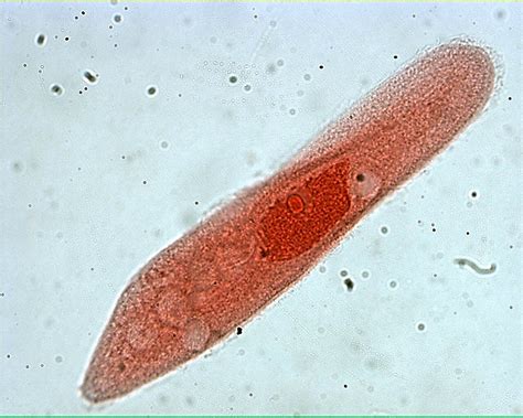 Paramecium 400X: General Biology Lab: Loyola University Chicago