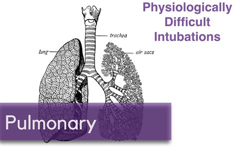 Physiologically Difficult Intubations — NUEM Blog