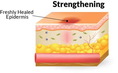 The Four Stages of Wound Healing and How to Treat Them—Home Care Delivered