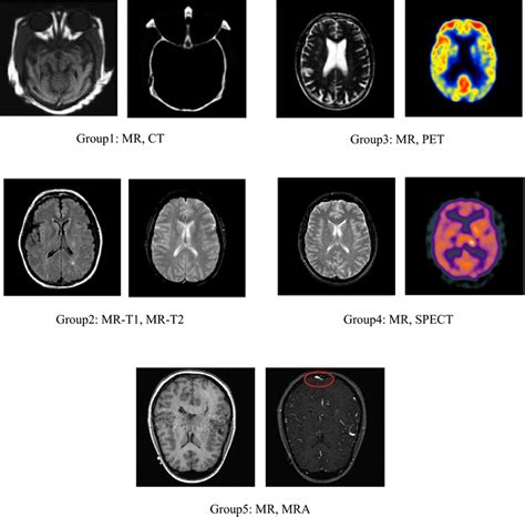 Multimodal medical image datasets | Download Scientific Diagram