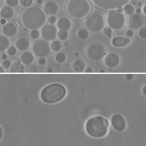 Light micrograph of vesicles in a micrograph (a), vesicles with ...