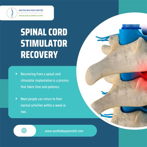 Spinal Cord Stimulator Surgery & Recovery | Southlake, Texas – South Lake Pain Center – Pain ...