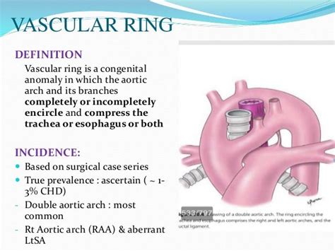 Vascular Ring Anomoly (VRA) - Canine-Megaesophagus: All About ME