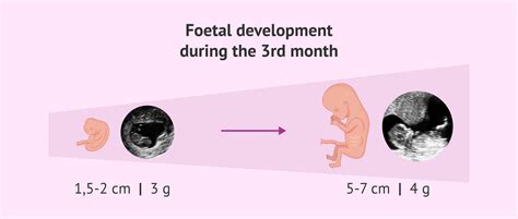 Fetal development at 3 months