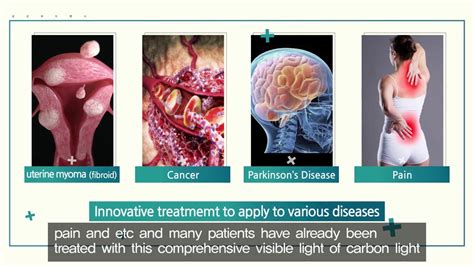 Visible light therapy (Full spectrum light system) - YouTube