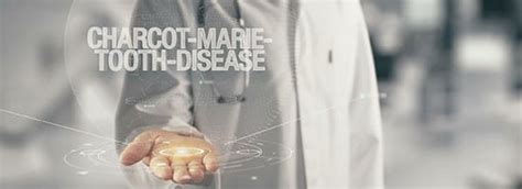 Charcot-Marie-Tooth Disease and Treatment Options | Orange County Orthopedic & Podiatry Group