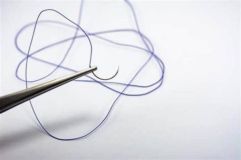 Suture Materials: Comprehensive Guide for Optimal Healing