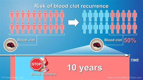 Preventing Another VTE