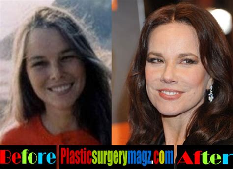 Barbara Hershey Plastic Surgery Before and After | | Plastic Surgery ...