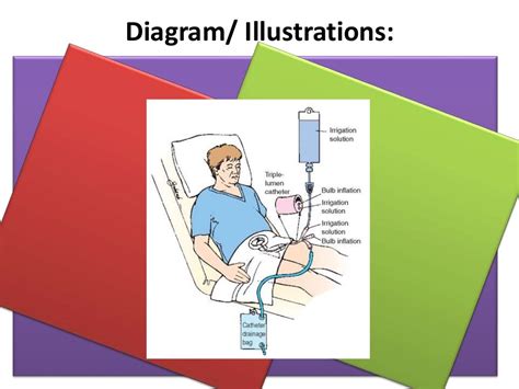 Cystoclysis bladder irrigation