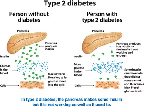 Type 1 vs. Type 2 - What is the Difference>