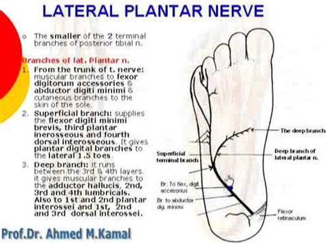 Plantar Nerve Entrapment