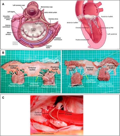 Frontiers | A review of the development of interventional devices for ...