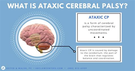 Introduction to Cerebral Palsy - ABC Law Centers