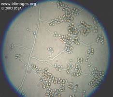 Sporothrix Images - Infectious Disease Images - eMicrobes Digital ...