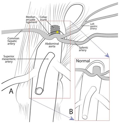 Arcuate Ligament