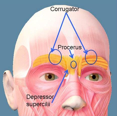 Contemporary Aesthetics > Learning Center > Upper Face | Muscles of the ...