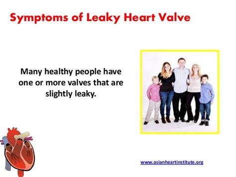 Asian Heart Institute - Leaky heart valve symptoms