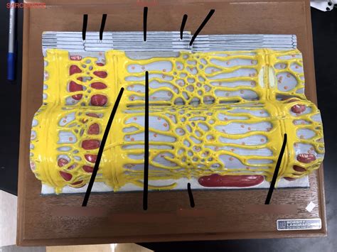 d- sarcomere model Diagram | Quizlet