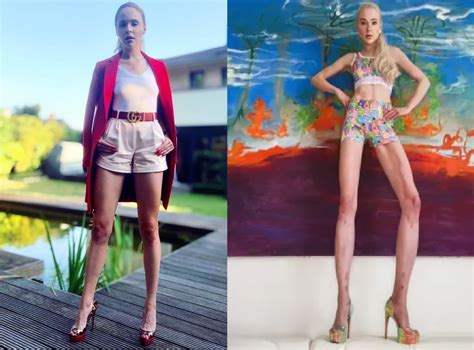 “Leg stretched 14 cm”… Famous female model who risked her life to have 'arm lengthening surgery ...