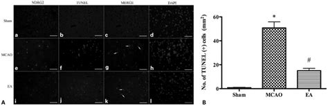 Immunofluorescent triple-labeling staining of deoxynucleotidyl... | Download Scientific Diagram