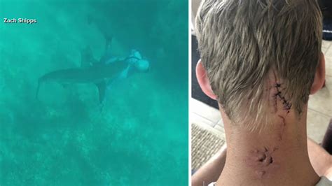 Man survives being bitten on head by shark while spearfishing in the ...