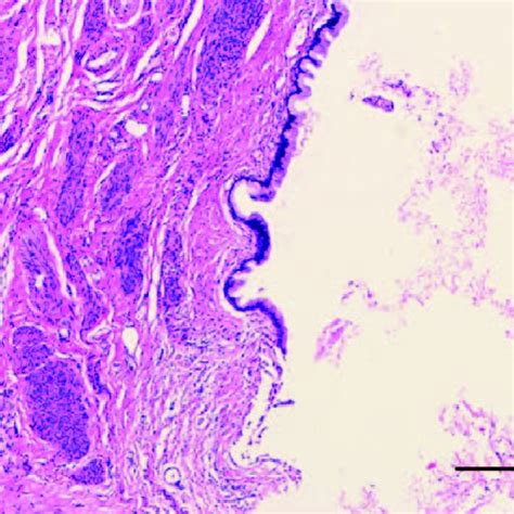 Histopathological images of the nabothian cyst showing the columnar... | Download Scientific Diagram