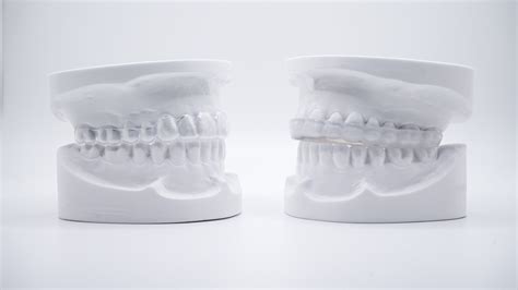 Retainer vs Night Guard for Teeth Grinding - Pro Teeth Guard