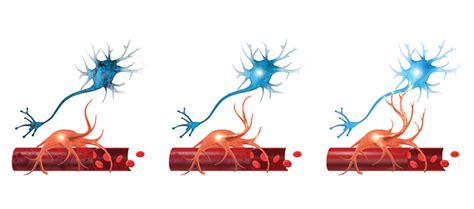 Neuroplasticity Treatment: How It Can Help You Recover From a Brain Injury