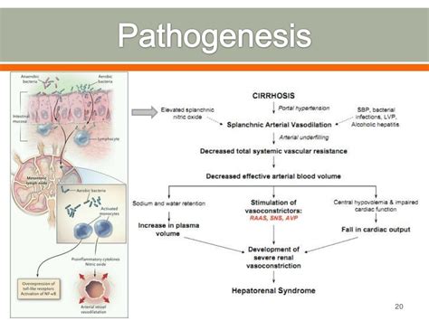 Hepatorenal syndrome