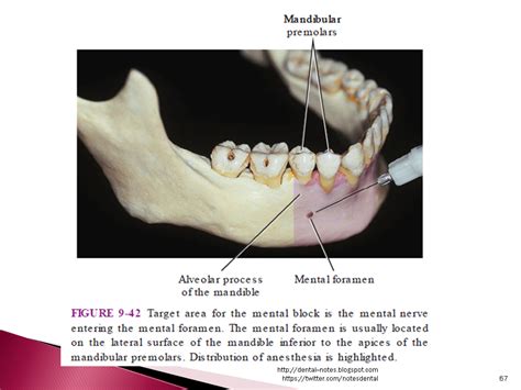 Dental Notes: Mental and Incisive Nerve Block NOTES