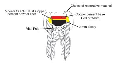 Articles about dentistry & dentists | Gossweiler office Dental Blog