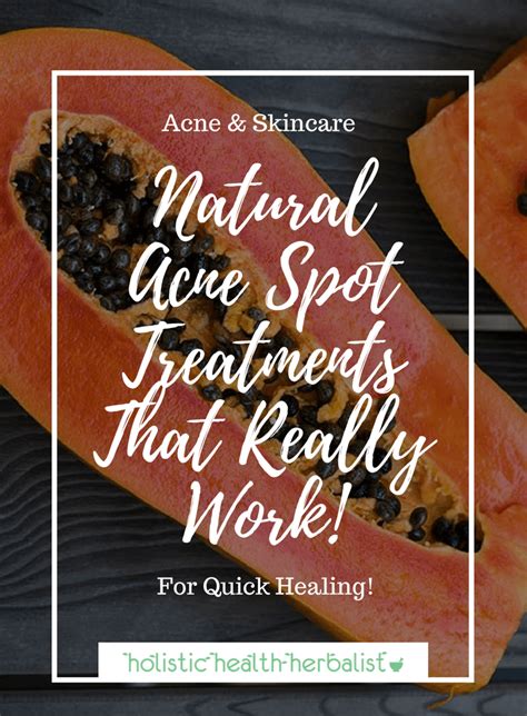 Natural Acne Spot Treatments That Really Work! - Holistic Health Herbalist