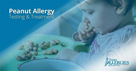 Peanut Allergy Treatment & Best Practices | Food Allergies Atlanta