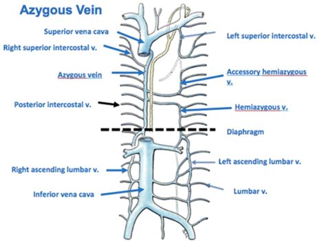 Znalezione obrazy dla zapytania ascending lumbar vein | Veins, Vena ...