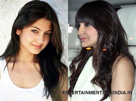 Anushka Sharma Before After