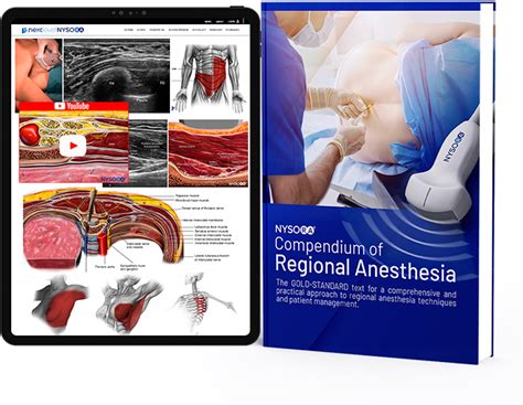 Nysora Compendium of Regional Anesthesia | PocketEDU