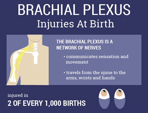 Brachial Plexus Injury Lawsuit | Infant Nerve Damage Lawyer