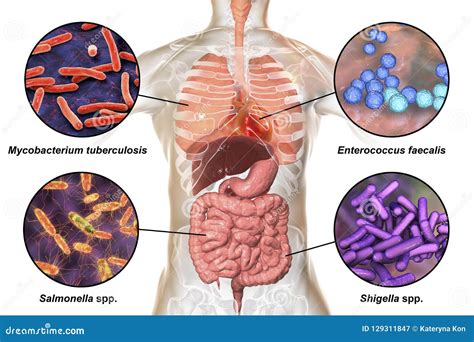 Enterococcus Faecalis. Pathogenic Flora. The Bacterium Causes ...