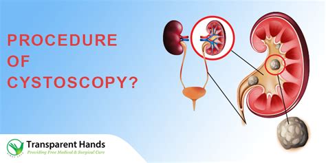 What is Cystoscopy?