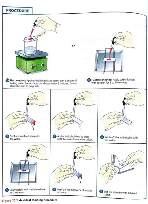 Acid Fast Staining Lab Report - KristinaknoeCross