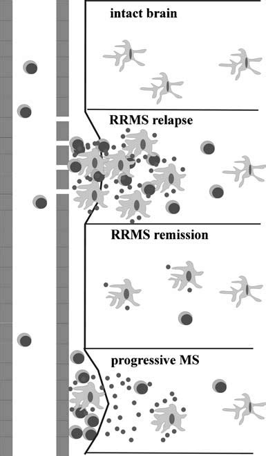 Inflammation of the central nervous system (CNS) in progressive... | Download Scientific Diagram