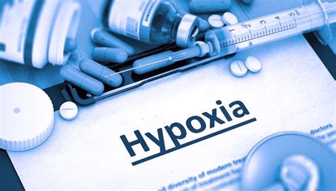 Empat Fakta Happy Hypoxia pada Covid-19 yang Harus Diketahui - TIMES Indonesia