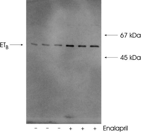 Western blot for ETB protein. Results represent 25 g of total protein ...