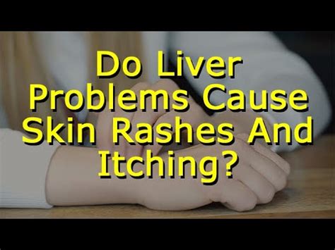 Liver Disease Skin Rashes