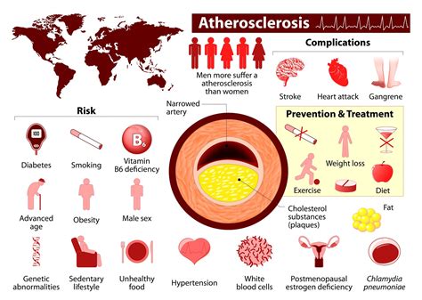 TOP 10 LIFESTYLE DISEASES INDIA- 2021 - 10Top.in