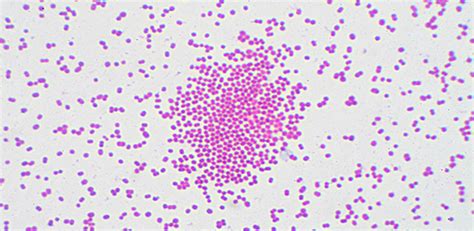 Acinetobacter Gram Stain Morphology