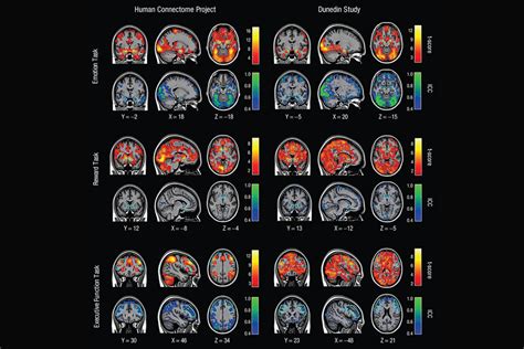 Studies of Brain Activity Aren’t as Useful as Scientists Thought | Duke ...