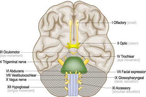 MRI Confirmed Bell's Palsy Presenting with Multiple Cranial Nerve Involvement EMRA