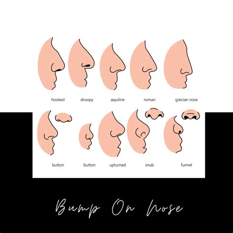 Bump On Your Nose? Is A Non Surgical Nose Job The Answer?